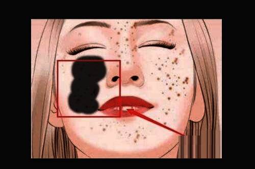 正在使用污点修复工具进行涂抹操作的示意图，光标覆盖在斑点区域上