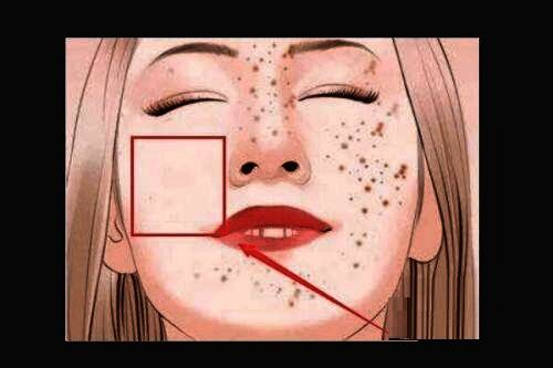 修复后的面部局部对比图，斑点完全清除，肤色更加白皙均匀