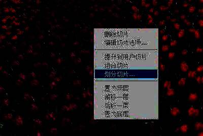 右键菜单展开，清晰列出各项切片操作命令，如编辑、删除等