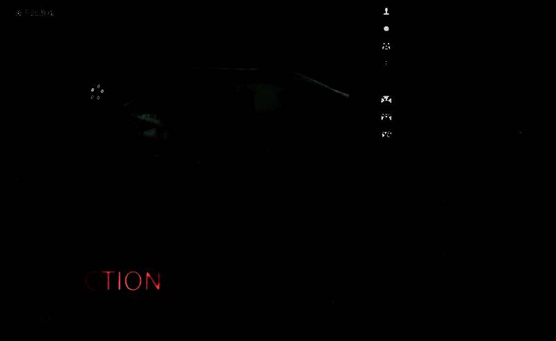 游戏界面显示多个监控仪表盘，玩家左手操控注射器，右手握持电钻，正在进行高难度牙齿修复