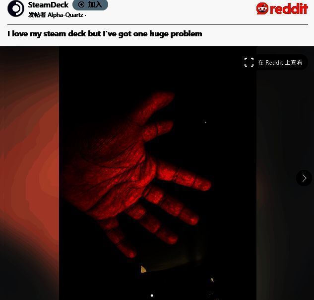 Reddit用户Alpha-Quartz展示其双手双拇指的生理特征，并配文说明操作Steam Deck时遇到的困难
