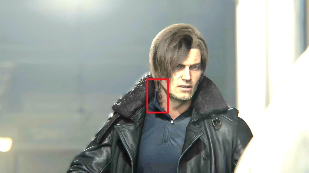 里昂面部特写镜头，颈部左侧可见明显黑色病变疤痕，皮肤呈现不自然的溃烂质感